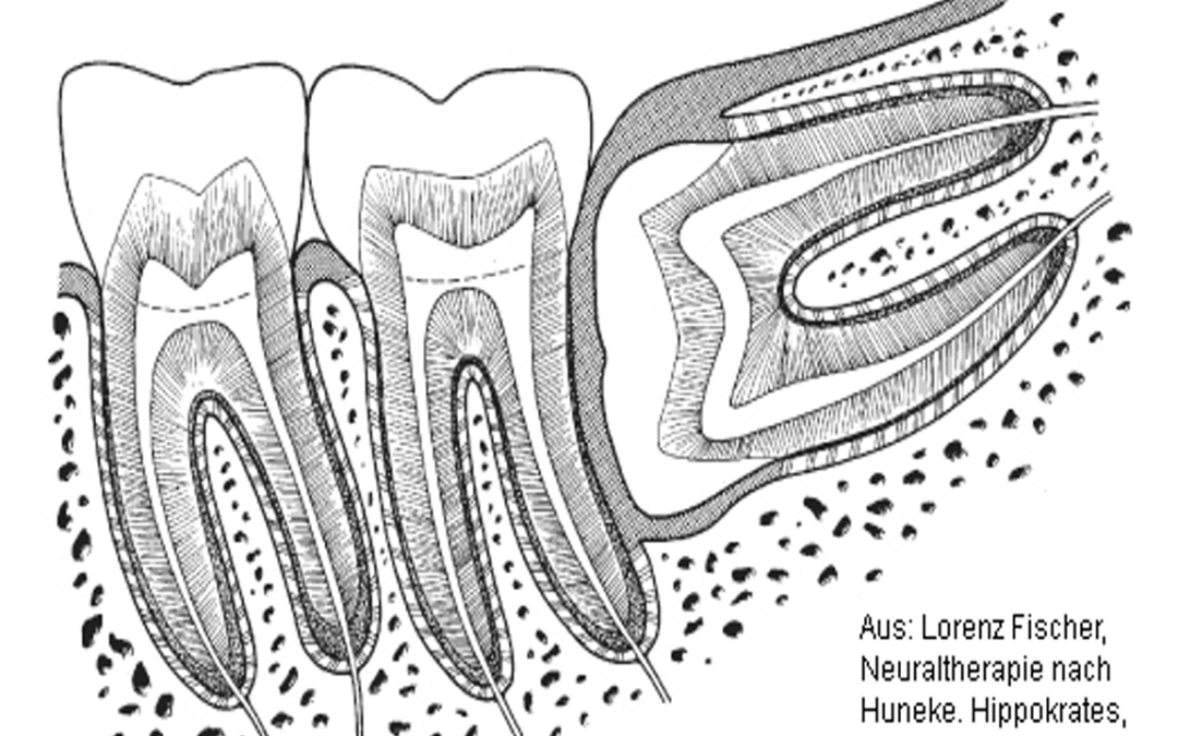 Neural Therapy for the daily practice